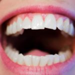 Mocne i zdrowe zęby bez próchnicy – zadbaj o nie już dziś. Próchnica – leczenie oraz profilaktyka